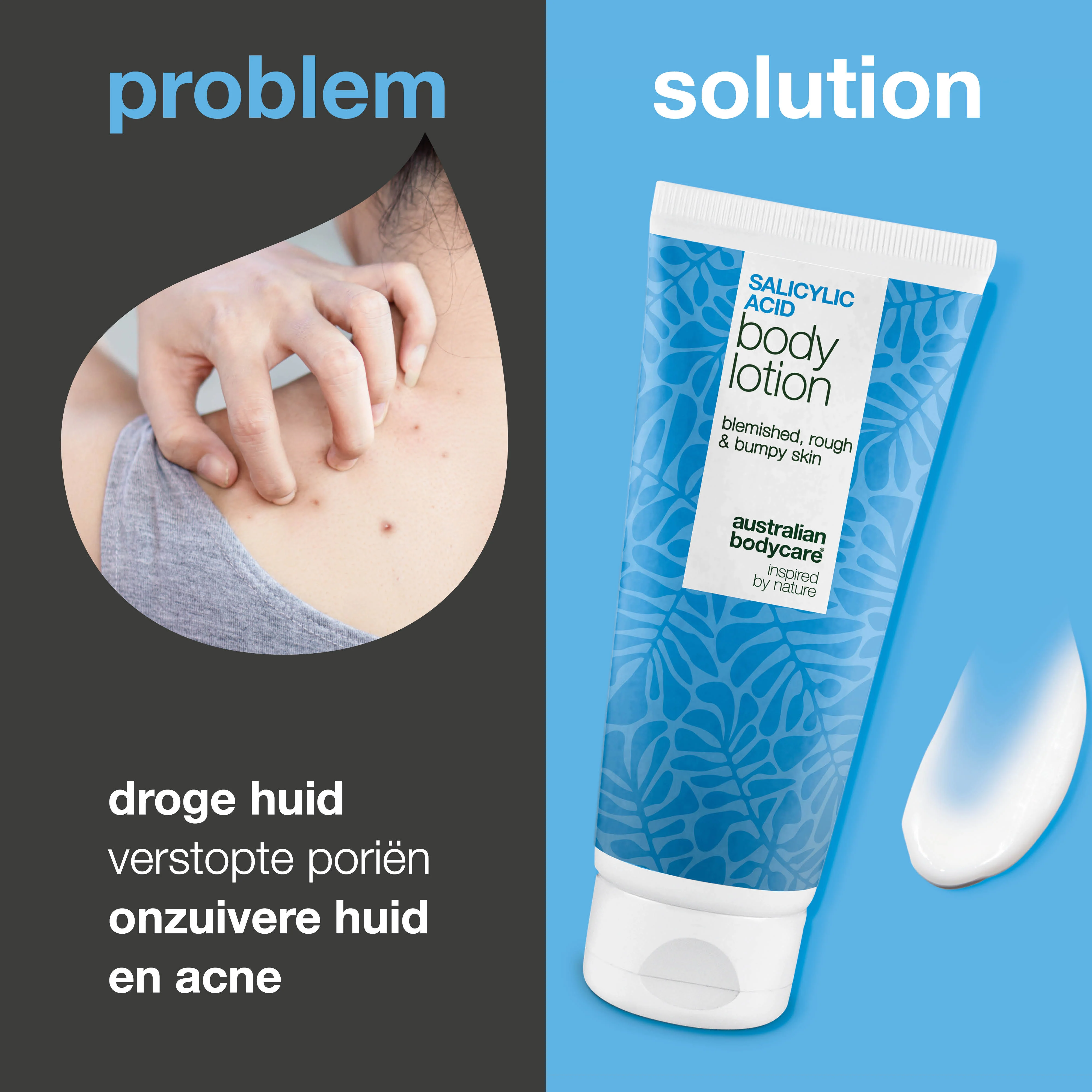 Body Lotion met salicylzuur – tegen onzuiverheden en droge huid —  Body Lotion met salicylzuur exfolieert, hydrateert en helpt bij onzuiverheden, ruwe en droge huid. Perfect voor dagelijks gebruik. - Image 3