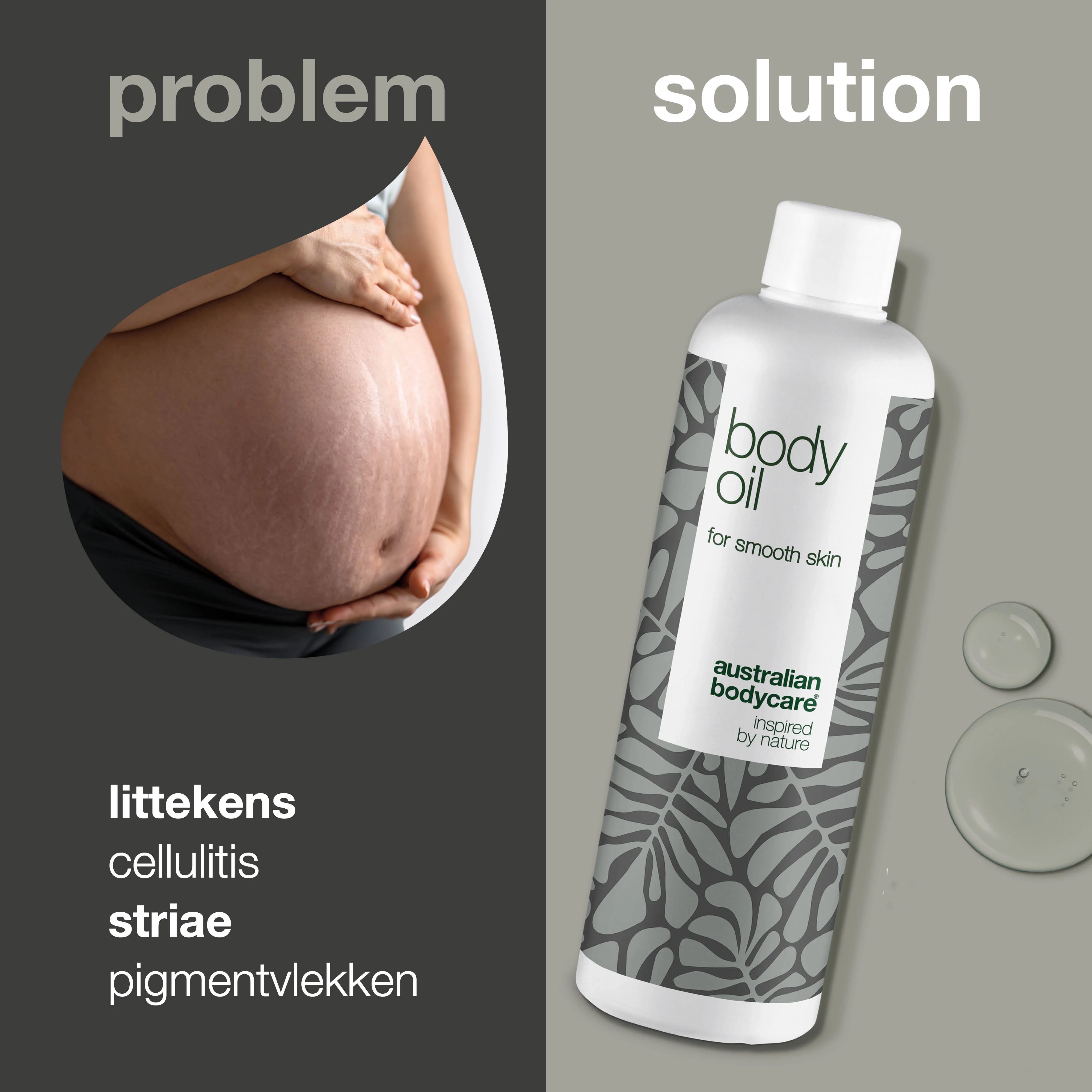 Body Oil – Vermindert striae, littekens en pigmentvlekken — Body Oil vermindert striae, littekens en pigmentvlekken. Met amandelolie, squalaan en vitamine E voor een gehydrateerde en zachte huid. - Image 2